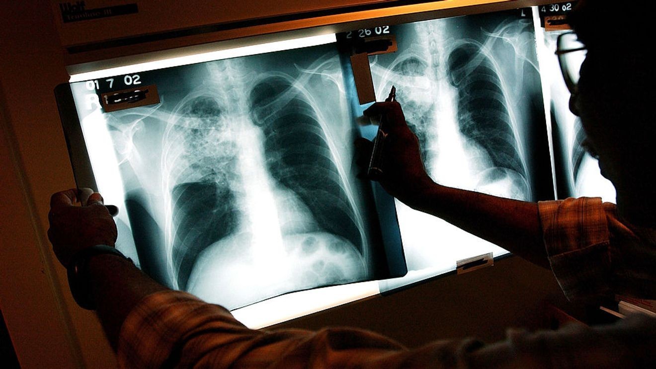 Meta partners with Ohio State medical college on AI research