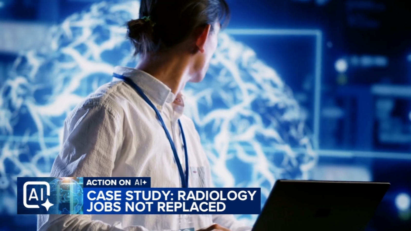 AI failed to replace radiologists, demand now higher than ever